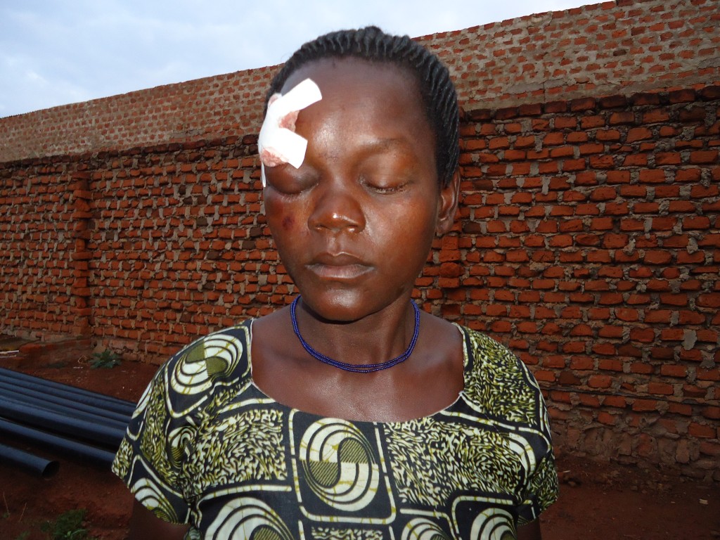 Battered woman