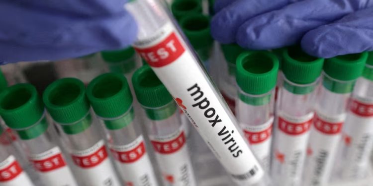 Spain to donate 500,000 mpox vaccine doses to combat outbreak in Africa