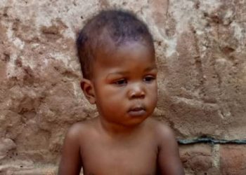 One-year-old Nakalembe needs Shs18.6m for heart surgery